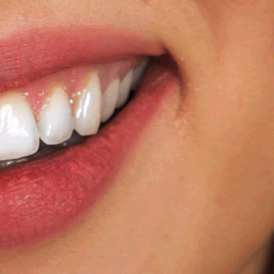 Estética dental en Coria del Río